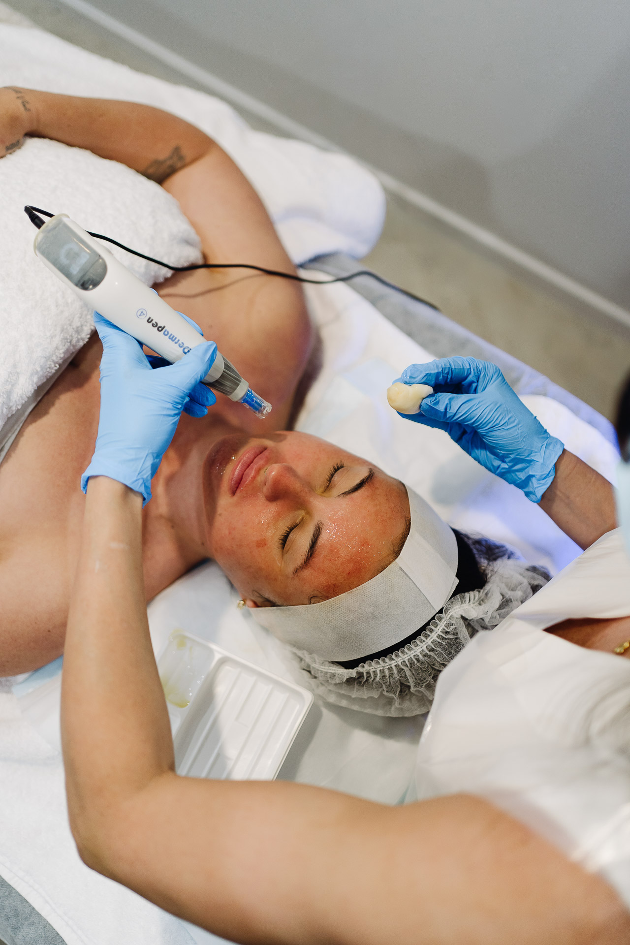 Skin Needling with Dermapen 4 at Cosmetics by Briony Brisbane