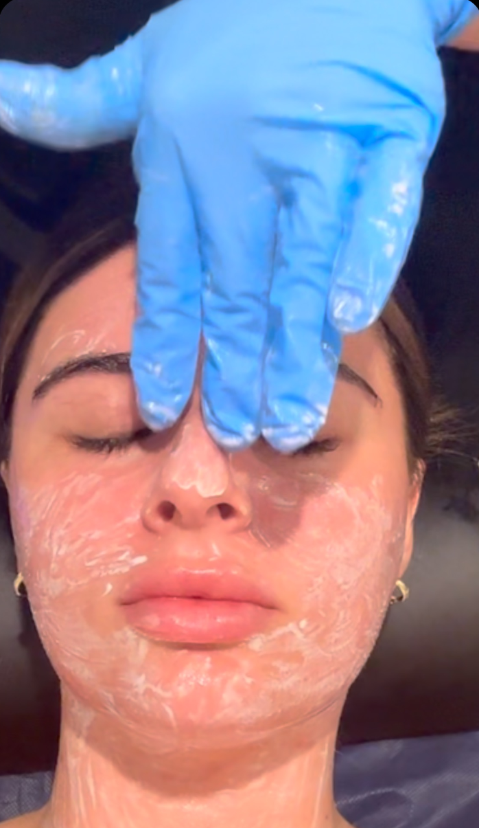 Professional Treatment Results - Cosmetics by Briony Brisbane Instagram Reel